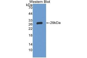 Western blot analysis of the recombinant protein. (GP5 anticorps  (AA 17-242))