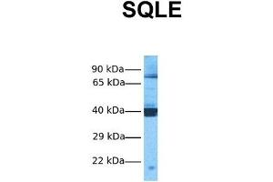 Host:  Rabbit  Target Name:  SQLE  Sample Tissue:  Human MCF7  Antibody Dilution:  1.