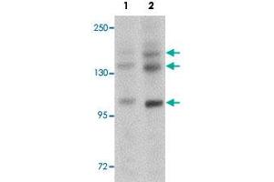 Western blot analysis of rat brain tissue with PRDM16 polyclonal antibody  at (Lane 1) 1 and (Lane 2) 2 ug/mL dilution. (PRDM16 anticorps  (C-Term))
