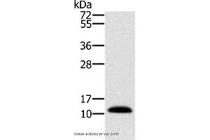 Western blot analysis of Human prostate tissue, using MSMB Polyclonal Antibody at dilution of 1:250 (MSMB anticorps)
