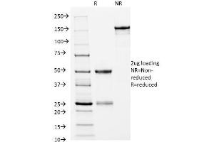 SDS-PAGE Analysis Purified HLA-DRB Mouse Monoclonal Antibody (L243). (HLA-DRB1 anticorps)