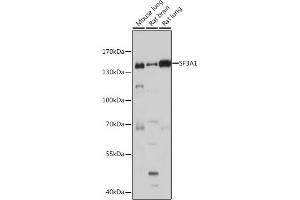 Western blot analysis of extracts of various cell lines, using SF3 antibody (ABIN1682670, ABIN3018893, ABIN3018894 and ABIN6220615) at 1:1000 dilution. (SF3A1 anticorps  (AA 443-793))