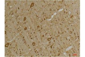 Immunohistochemistry (IHC) analysis of paraffin-embedded Rat Brain Tissue using GABA A Receptor gamma2 Rabbit Polyclonal Antibody diluted at 1:200. (GABRG2 anticorps)