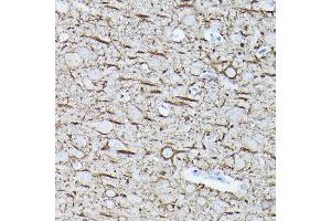 Immunohistochemistry of paraffin-embedded rat brain using Neurofilament L Rabbit mAb (ABIN7268867) at dilution of 1:100 (40x lens). (NEFL anticorps)