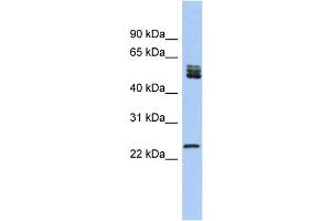WB Suggested Anti-SFRS7 Antibody Titration: 0. (SFRS7 anticorps  (N-Term))