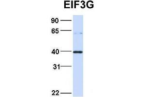 Host:  Rabbit  Target Name:  EIF3G  Sample Type:  293T  Antibody Dilution:  1.