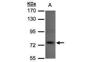 TLK1 anticorps