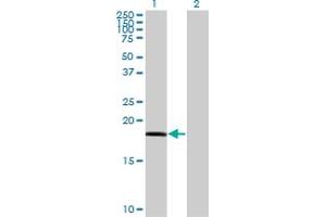 Western Blot analysis of RARRES3 expression in transfected 293T cell line by RARRES3 monoclonal antibody (M10), clone 1H5. (RARRES3 anticorps  (AA 1-164))
