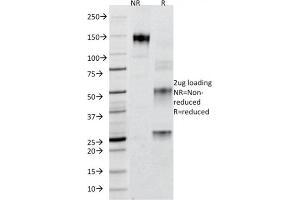 SDS-PAGE Analysis Purified Adipophilin Mouse Monoclonal Antibody (ADFP/1365).