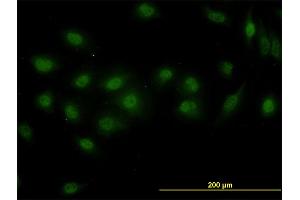 Immunofluorescence of monoclonal antibody to DPF2 on HeLa cell. (DPF2 anticorps  (AA 56-155))