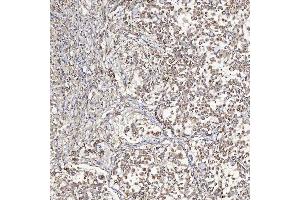 IHC analysis of SFXN5 using anti-SFXN5 antibody (ABIN7601388). (Sideroflexin 5 anticorps  (AA 34-340))