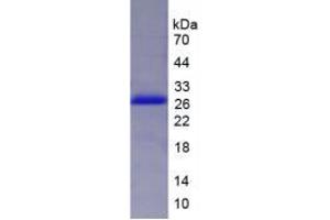 SDS-PAGE analysis of Human DVL2 Protein. (DVL2 Protéine)