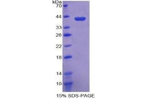 SDS-PAGE of Protein Standard from the Kit (Highly purified E. (CRYL1 Kit ELISA)