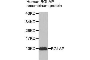 Western blot analysis of extracts of Human BGLAP recombinant protein, using BGLAP antibody. (Osteocalcin anticorps)