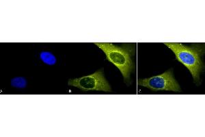 Immunocytochemistry/Immunofluorescence analysis using Rabbit Anti-Rab4 Polyclonal Antibody (ABIN361840 and ABIN361841). (Rab4 anticorps  (C-Term))