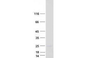 Validation with Western Blot