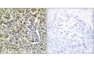 Immunohistochemistry (IHC) image for anti-Collagen, Type VI, alpha 2 (COL6A2) (AA 691-740) antibody (ABIN2889918) (COL6A2 anticorps  (AA 691-740))