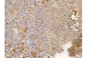 MKK3/MKK6 Antibody at 1/100 staining human normal tonsil tissue by IHC-P. (MAP2K3 anticorps)