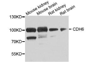 Western blot analysis of extracts of various cell lines, using CDH6 antibody. (CDH6 anticorps  (AA 1-250))