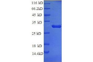 Tissue Factor Pathway Inhibitor (Lipoprotein-Associated Coagulation Inhibitor) (TFPI) (AA 25-300) protein (His tag)