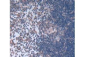 Used in DAB staining on fromalin fixed paraffin- embedded Kidney tissue