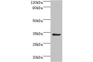 Western blot All lanes: Aminoacyl tRNA synthase complex-interacting multifunctional protein 1 antibody at 2 μg/mL + HepG2 whole cell lysate Secondary Goat polyclonal to rabbit IgG at 1/10000 dilution Predicted band size: 35, 38 kDa Observed band size: 35 kDa (AIMP1 anticorps  (AA 25-180))