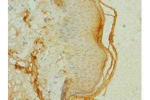 Immunohistochemistry of paraffin-embedded human skin tissue using ABIN7152849 at dilution of 1:100 (FRS3 anticorps  (AA 101-400))