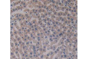 IHC-P analysis of liver tissue, with DAB staining. (Paxillin anticorps  (AA 327-568))