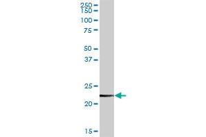 CLTB MaxPab rabbit polyclonal antibody. (CLTB anticorps  (AA 1-211))