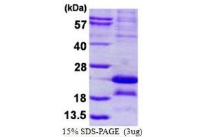 Image no. 1 for Melanoma Antigen Family A, 5 (MAGEA5) protein (His tag) (ABIN1098595) (MAGEA5 Protein (His tag))