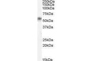 Kallikrein 1 (KLK1) peptide
