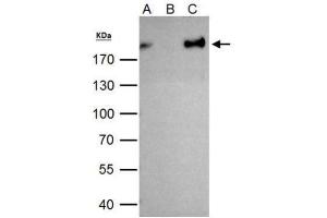 IP Image ZEB1 antibody immunoprecipitates ZEB1 protein in IP experiments. (ZEB1 anticorps)