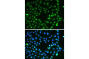 Immunofluorescence analysis of A549 cell using SALL4 antibody. (SALL4 anticorps)