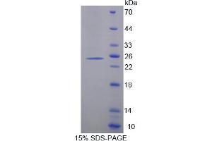 Image no. 1 for Cytochrome P450, Family 26, Subfamily A, Polypeptide 1 (CYP26A1) (AA 73-255) protein (His tag) (ABIN6236995) (CYP26A1 Protein (AA 73-255) (His tag))