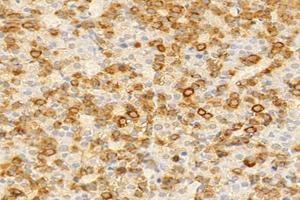 Immunohistochemistry analysis of paraffin-embedded rat pituitary gland using,GH1 (ABIN7074136) at dilution of 1: 2000