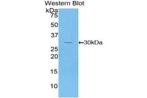 Western Blotting (WB) image for anti-Phosphoinositide-3-Kinase, Class 2, alpha Polypeptide (PIK3C2A) (AA 172-403) antibody (ABIN1860217)