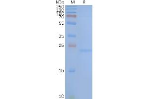 Transmembrane 4 L Six Family Member 1 (TM4SF1) protein