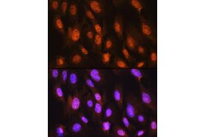 Immunofluorescence analysis of C6 cells using DDIT3/CHOP Rabbit pAb (ABIN6131563, ABIN6139461, ABIN6139464 and ABIN6222163) at dilution of 1:100. (DDIT3 anticorps)