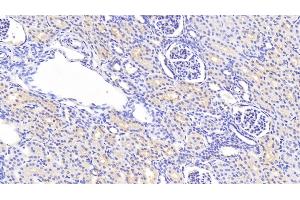 anti-Actinin, alpha 1 (ACTN1) (AA 28-260) antibody