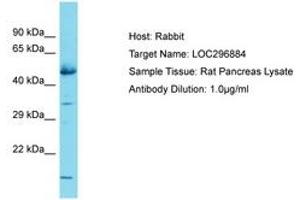 Image no. 1 for anti-Glucocorticoid Induced Transcript 1 (GLCCI1) (AA 255-304) antibody (ABIN6750335) (GLCCI1 anticorps  (AA 255-304))
