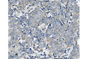 IHC analysis of FIS1 using anti-FIS1 antibody (ABIN7598965). (Fission 1 anticorps  (AA 1-121))