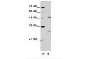 Image no. 2 for anti-Eukaryotic Translation Initiation Factor 4H (EIF4H) (AA 149-198) antibody (ABIN203036) (EIF4H anticorps  (AA 149-198))