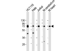 All lanes : Anti-TCF7L2 Antibody (N-term) at 1:2000 dilution Lane 1: HC whole cell lysate Lane 2: Hela whole cell lysate Lane 3: Jurkat whole cell lysate Lane 4: mouse cerebellum lysate Lane 5: mouse heart lysate Lysates/proteins at 20 μg per lane.