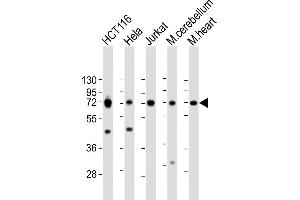 All lanes : Anti-TCF7L2 Antibody (N-term) at 1:2000 dilution Lane 1: HC whole cell lysate Lane 2: Hela whole cell lysate Lane 3: Jurkat whole cell lysate Lane 4: mouse cerebellum lysate Lane 5: mouse heart lysate Lysates/proteins at 20 μg per lane. (TCF7L2 anticorps  (N-Term))