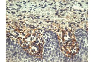 Immunohistochemistry staining of tonsil (paraffin-embedded sections) with anti-human tenascin C (T2H5).