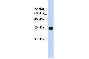 WB Suggested Anti-TNRC5 Antibody Titration:  0. (TNRC5 anticorps  (C-Term))