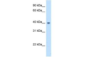WB Suggested Anti-ABHD5 Antibody Titration:  5.