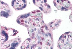 Human Placenta: Formalin-Fixed, Paraffin-Embedded (FFPE)