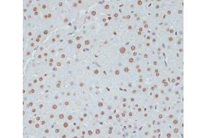 Immunohistochemistry of paraffin-embedded Rat liver using Phospho-p53(S33) Polyclonal Antibody at dilution of 1:100 (40x lens).