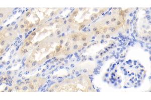 Detection of PRDX6 in Bovine Kidney Tissue using Polyclonal Antibody to Peroxiredoxin 6 (PRDX6)